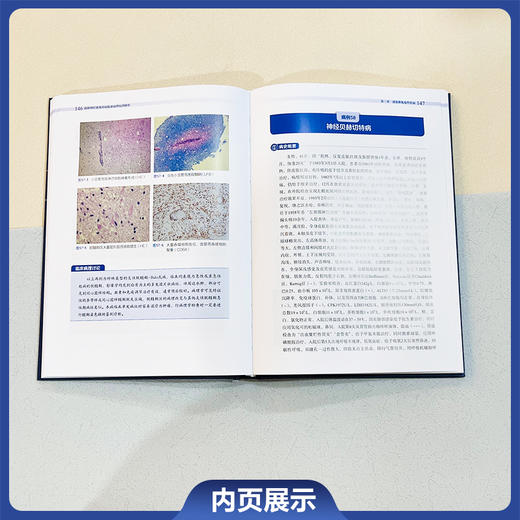 协和神经系统疾病临床病理病例解析 郭玉璞编 涵盖了神经系统各大类疾病如脑血管病 肿瘤 感染性疾病 免疫性疾病 遗传病 变性病等 商品图4