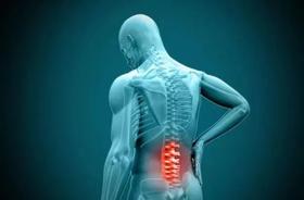  骨质增生疼痛难治，艾灸直达病灶，减轻骨刺增生疼痛！ 