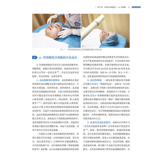 化学剥脱术皮肤科临床应用高阶 蒋献 系统阐述化学剥脱剂的种类 化学剥脱术的分类和作用原理 适应证和禁忌证及其在皮肤病中的应用 商品图4