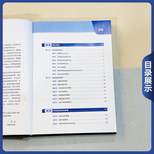 协和神经系统疾病临床病理病例解析 郭玉璞编 涵盖了神经系统各大类疾病如脑血管病 肿瘤 感染性疾病 免疫性疾病 遗传病 变性病等 商品图3