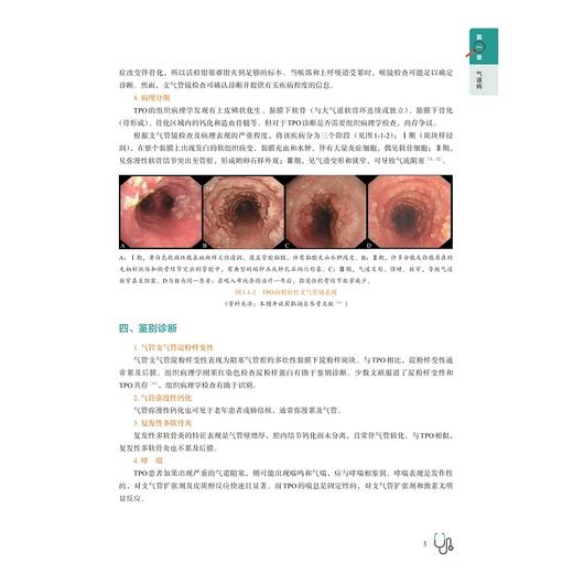 呼吸系统罕见病（第一辑）/白春学/宋元林/孙加源/王利民/金伟中/浙江大学出版社 商品图3