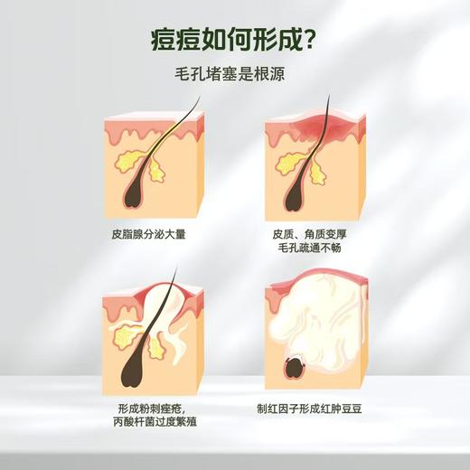 御豆堂 草本祛痘皂，深层清洁祛痘，持久保湿，告别油光痘痘 商品图3