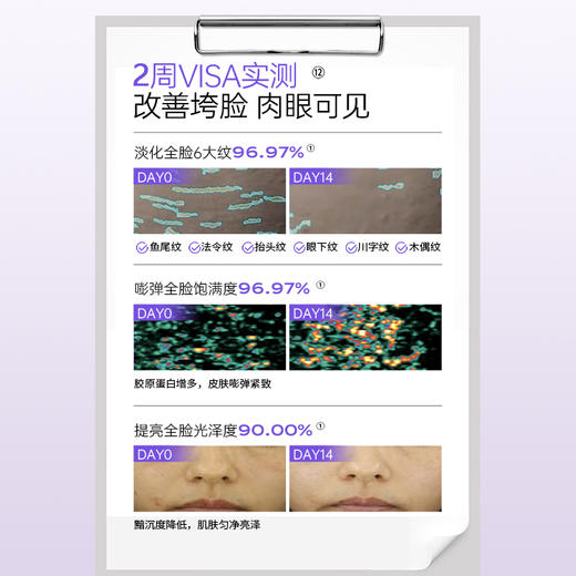 【2周淡纹】优理氏羊胎素淡纹弹嫩冻干絮套组3.0组合 紧致淡纹抗皱抗衰老精华细胞级抗皱精华 商品图6