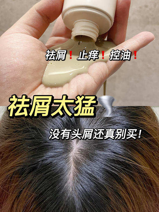 【和真源屑满净洗发乳】祛屑天花板顽固头屑、干性、油性、真菌性头屑都好用，给头皮做SPA 亲测好用，强烈建议围。堪比医护级草本养护安全无激素，儿童也放心用 商品图3