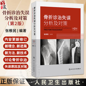 骨折诊治失误分析及对策 第2二版 张根民 病史采集中的失误 对骨折的严重并发症重视不够 石膏固定不当的分析及对策人民卫生出版社