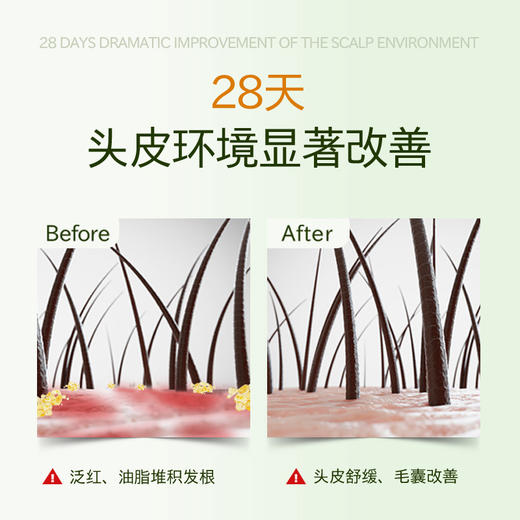 【临期清货】25年5月 波兰Radical马尾草护理精华液400ml  送喷雾瓶 包邮包税 保税直发 商品图3