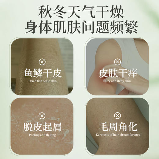 百年扁氏止痒润肤露 商品图1