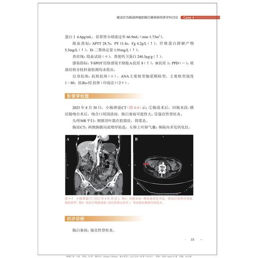 肠道疑难病例多学科讨论（第五辑）/沈骏/田丰/曹晓沧/顾于蓓/李玥/梁洁/浙江大学出版社 商品图4