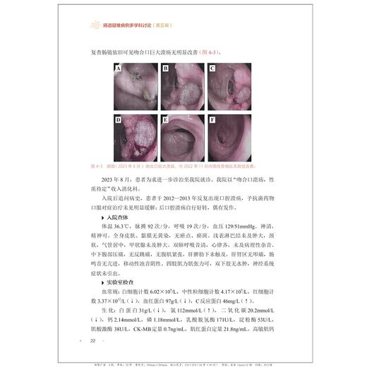 肠道疑难病例多学科讨论（第五辑）/沈骏/田丰/曹晓沧/顾于蓓/李玥/梁洁/浙江大学出版社 商品图3