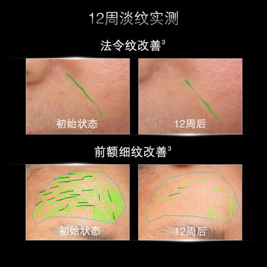 修丽可P-TIOX多肽精华30ml 淡纹紧致修护保湿【CDF】 商品图3