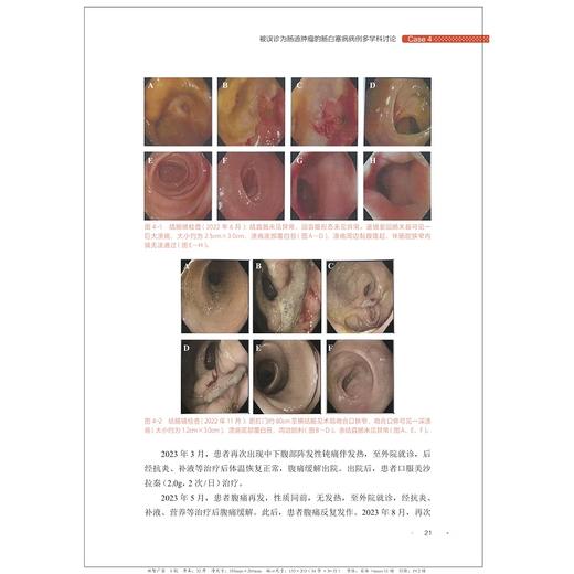 肠道疑难病例多学科讨论（第五辑）/沈骏/田丰/曹晓沧/顾于蓓/李玥/梁洁/浙江大学出版社 商品图2