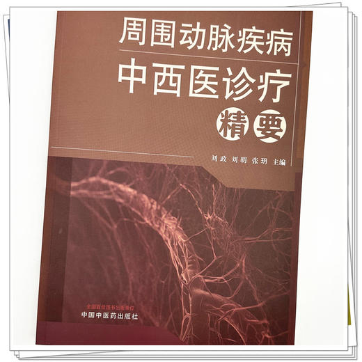 周围动脉疾病中西医诊疗精要 刘政 刘明 张玥 主编 中国中医药出版社 商品图3