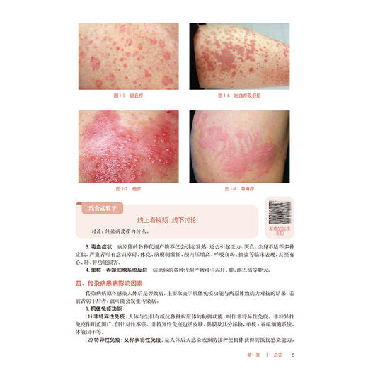 传染病护理 第3版 十四五规划教材全国高等职业教育专科教材 张小来主编 供护理助产专业用 高职高专9787117370677人民卫生出版社 商品图4