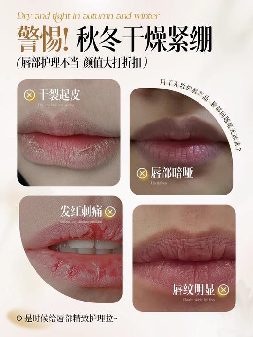 儒意唇部精华油 润唇补水保湿滋润淡化唇纹去死皮防干裂护理 男女可用1.5ml 商品图1