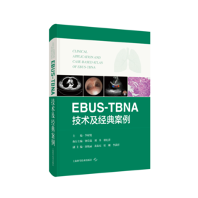EBUS-TBNA技术及经典案例