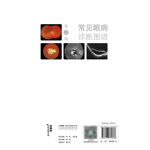 常见眼病诊断图谱（第2版） 2024年11月参考书 商品图2