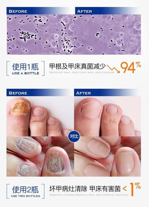 春节不打烊【Breathy洋甘菊蓖麻子油抑菌液】从根源解决所有问题 ，用了就有效 专攻顽固灰指用，深层渗透，抑菌率99%改善指甲营养不良，修复美甲受损，滋润指甲 商品图3