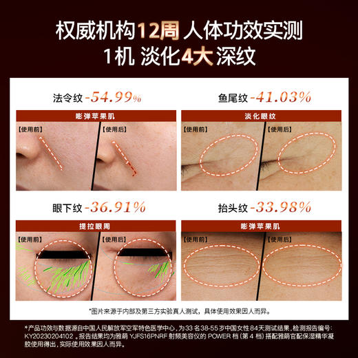 雅萌ACE六代射频美容仪 商品图5