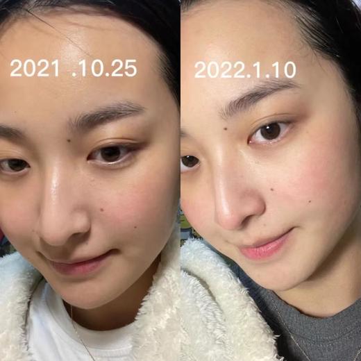 【春节不打烊】城野医生377精华提亮肤色淡化痘印斑点18g 商品图1