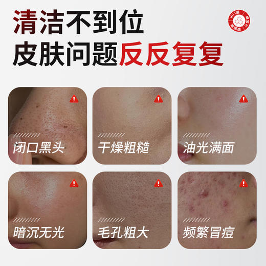 【梵西新品 119元任选3件】梵西山壬二酸清洁泥膜棒去黑白头收缩毛孔粉刺清洁神器水杨酸面膜 商品图1