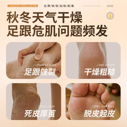 【金币兑换】梵西足跟皴裂凝露滚珠脚后跟防干裂修护霜秋冬滋润足膜皲裂膏正品 60ml/瓶 商品图1