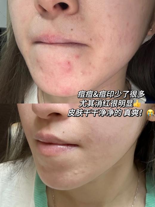 【2.3王炸割肉价】修丽可稀有果酸精华4ml*3（外标效期3年到25.1月，国际5年可用到27年1月！介意慎拍！) 商品图2