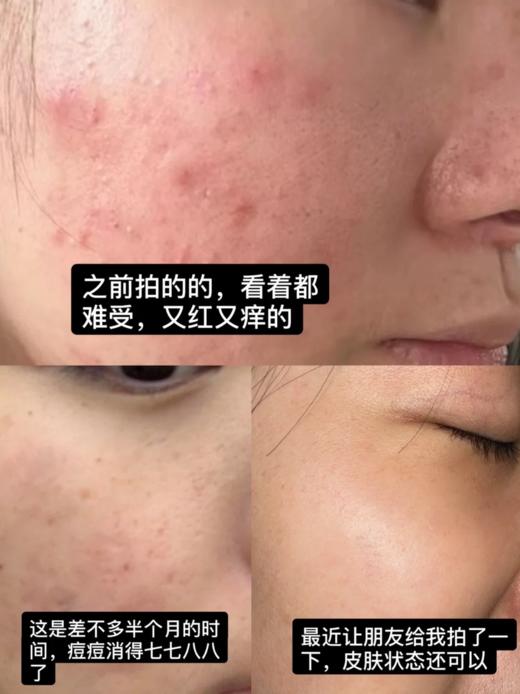 【2.3王炸割肉价】修丽可稀有果酸精华4ml*3（外标效期3年到25.1月，国际5年可用到27年1月！介意慎拍！) 商品图3