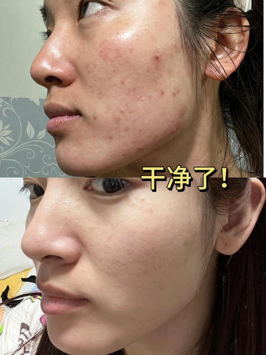 【2.3王炸割肉价】修丽可稀有果酸精华4ml*3（外标效期3年到25.1月，国际5年可用到27年1月！介意慎拍！) 商品图4