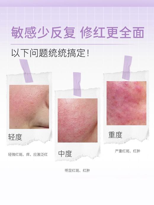 5+5舒缓冰纯乳20g乳液冰晶舒缓防敏退红吾加吾 商品图5