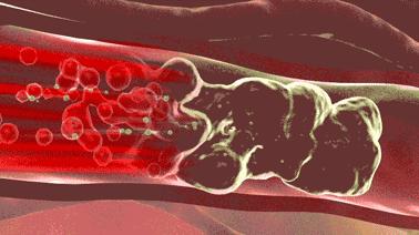【泰国 JXXINLIN腰间盘突出】专攻腰间盘突出、腰椎酸痛 抹一抹!自带防伪  通络止痛，缓解损伤肿痛 守护腰椎健康!!全家都能一起用! 商品图5