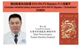 Top01 椎动脉复杂动脉瘤ECA-RA-P2 Bypass+介入