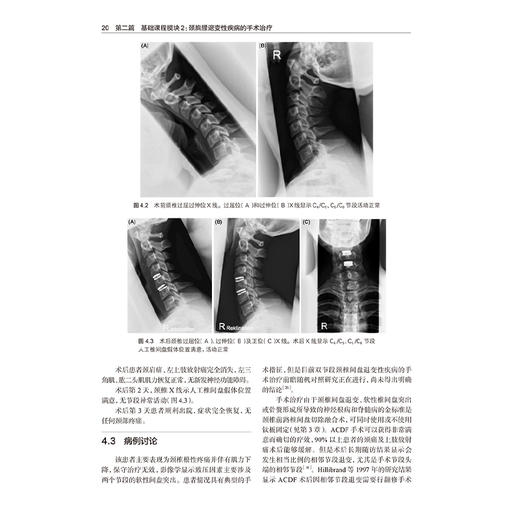 脊柱外科 临床思辨与病例点评 马晓生 主编 该书配有大量清晰的病例影像学资料 可以帮助读者迅速理解相关内容 人民卫生出版社 商品图4