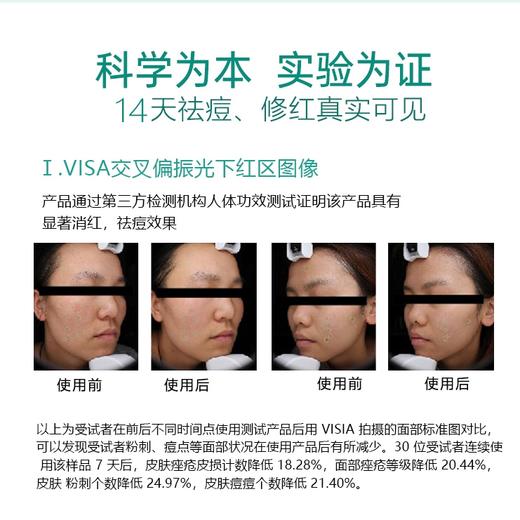 梵秀伊净颜多效祛痘乳20ml 商品图3