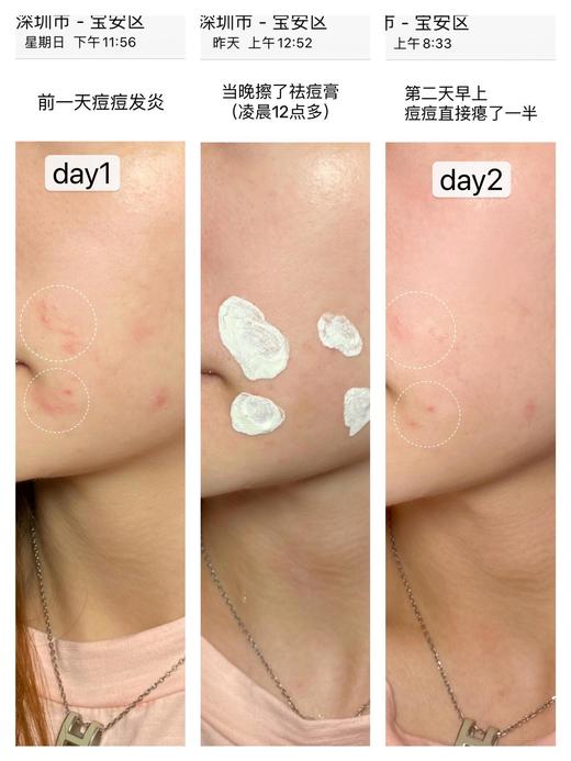 马林狗子夜间净痘精华小白瓶干湿分离修复红肿淡印14ml 商品图7