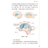 脑健康处方 配增值 健康中国你我同行科普读物 国家卫生健康委宣传司 组织编写 常见脑血管病有哪些 人民卫生出版社 9787117376419 商品缩略图4