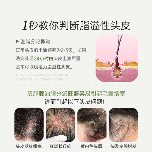 Bioblas德国荨麻脂溢洗发水 商品图2