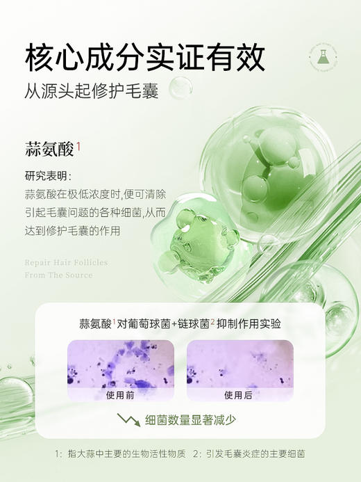 Bioblas大蒜毛囊洗发水除螨炎去屑止痒头皮清洁控油蓬松洗头膏露 商品图7