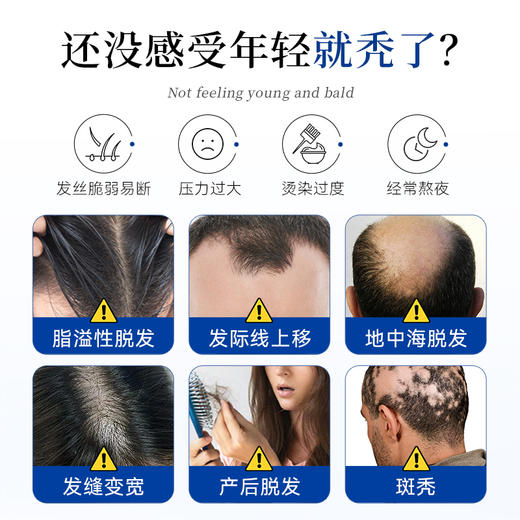 GRISSO格瑞索锯棕榈生物素片脱养发防际头线增长 商品图1