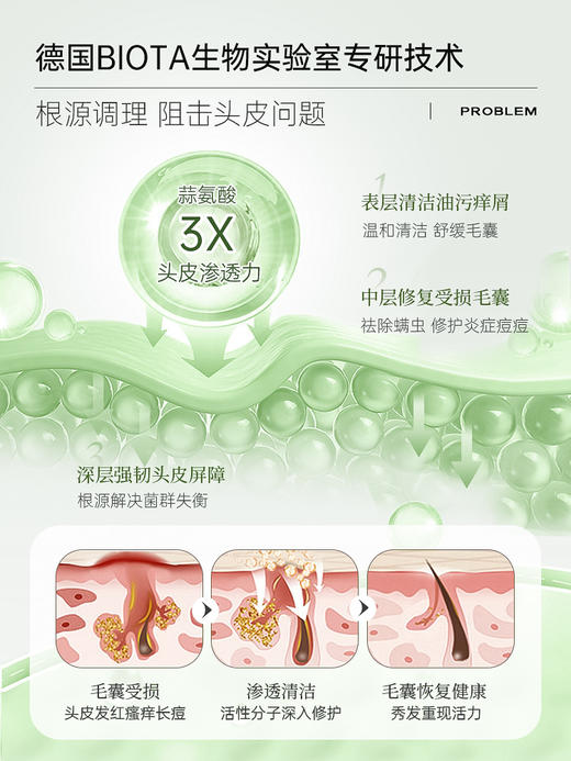 Bioblas大蒜毛囊洗发水除螨炎去屑止痒头皮清洁控油蓬松洗头膏露 商品图8
