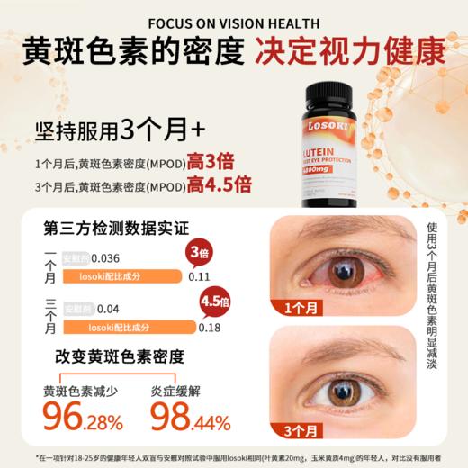 losoki叶黄素护眼片眼睛成人学生保健品眼干痒红血丝老人旗舰正品 商品图1