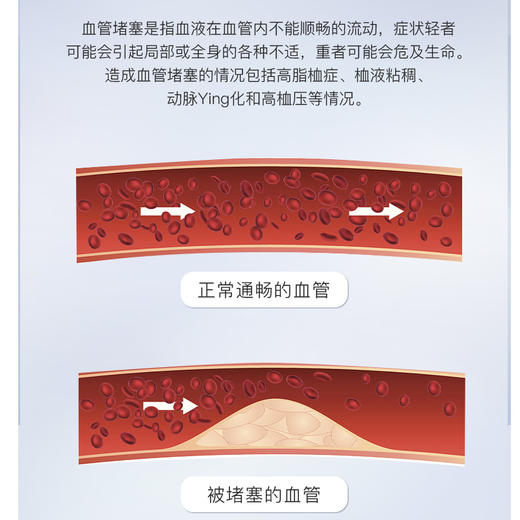 GOLDSKY官方正品进口纯南极磷虾油60磷脂升级版omega3鱼油 商品图2