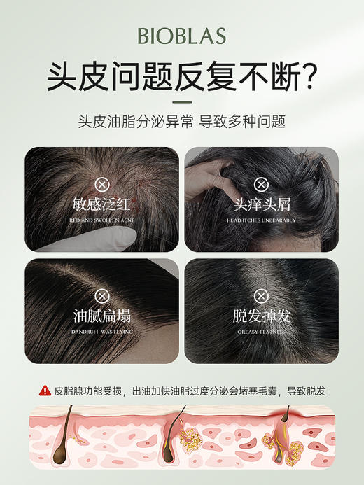 Bioblas大蒜毛囊洗发水除螨炎去屑止痒头皮清洁控油蓬松洗头膏露 商品图1