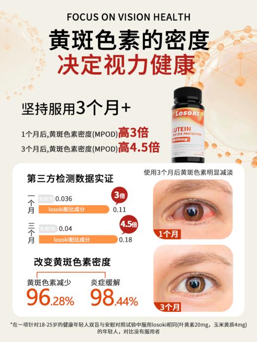 losoki叶黄素护眼片眼睛成人学生保健品眼干痒红血丝老人旗舰正品 商品图3