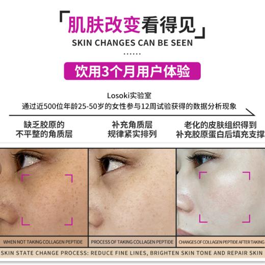 [18盒]美国乐斯可losoki胶原蛋白肽内服美白小分子口服液官方正品 商品图1