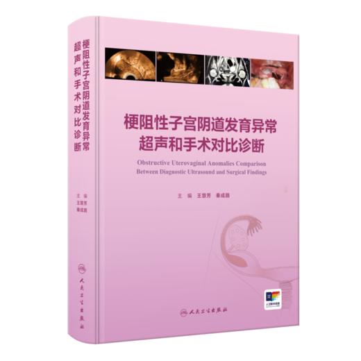 梗阻性子宫阴道发育异常超声和手术对比诊断 商品图0