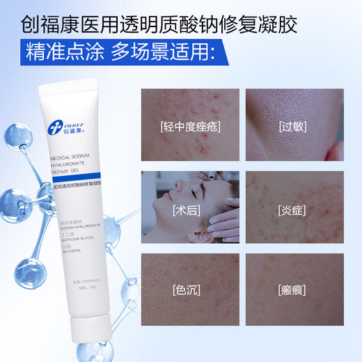 【双旦礼遇季|可用券】创福康 医用透明质酸钠修复凝胶 30g 商品图5