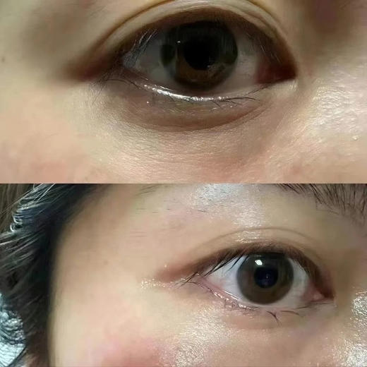 涂抹式肉毒！Armani阿玛尼黑钥匙眼霜1ml（27.6月） 商品图6