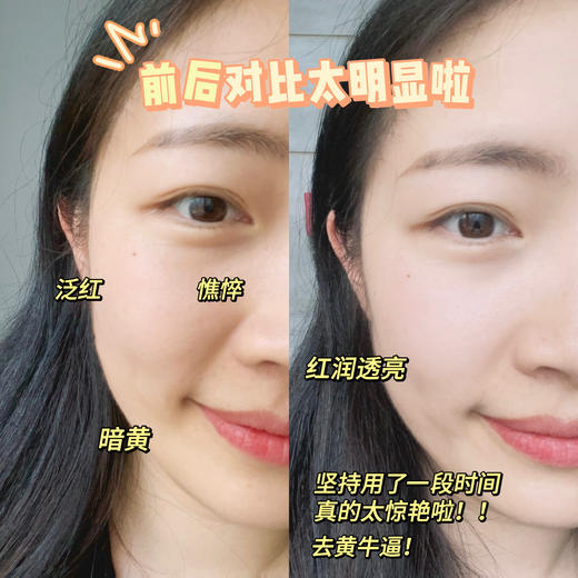 【光感4件套】暗沉肌 熬夜肌必备 天然焕亮 高能抗氧化  狙击暗沉 抗糖焕肤 光感透亮4件套（配礼盒，送礼更体面） 商品图4