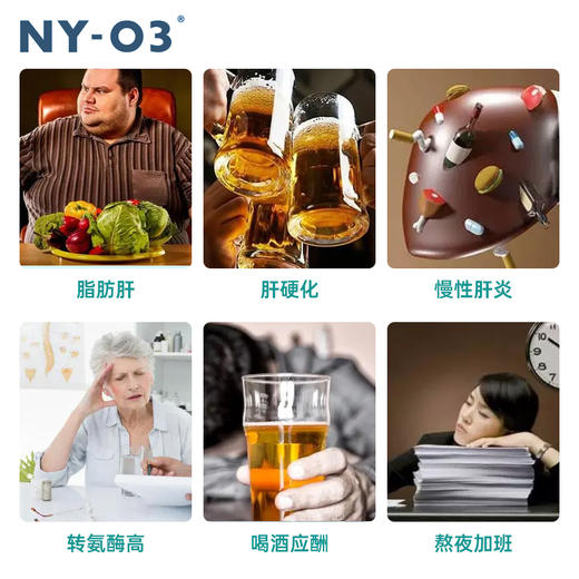 NYO3护肝片挪威进口140倍奶蓟草小绿盾水飞蓟素加班熬夜应酬保健 商品图2