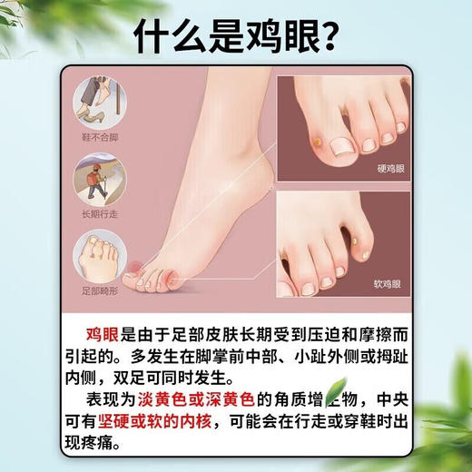 马应龙水杨酸软膏10g头癣足癣去角质增生去鸡皮正品尿素组合 商品图1